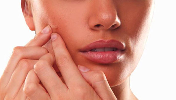 ব্রন এবং এর দাগ প্রতিরোধে করণীয়