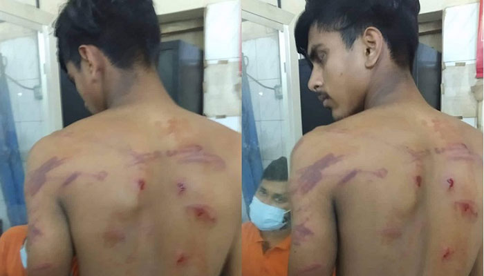 ক্লাসে হাসাহাসি: শিক্ষার্থীকে পিটিয়ে হাসপাতালে পাঠালেন শিক্ষক