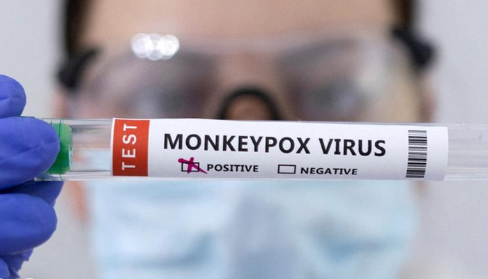 মঙ্কিপক্স ছড়িয়ে পড়ায় যুক্তরাষ্ট্রে জরুরি অবস্থা