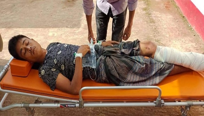 তুমব্রু সীমান্তে মাইন বিস্ফোরণ, বাংলাদেশি যুবকের পা বিচ্ছিন্ন