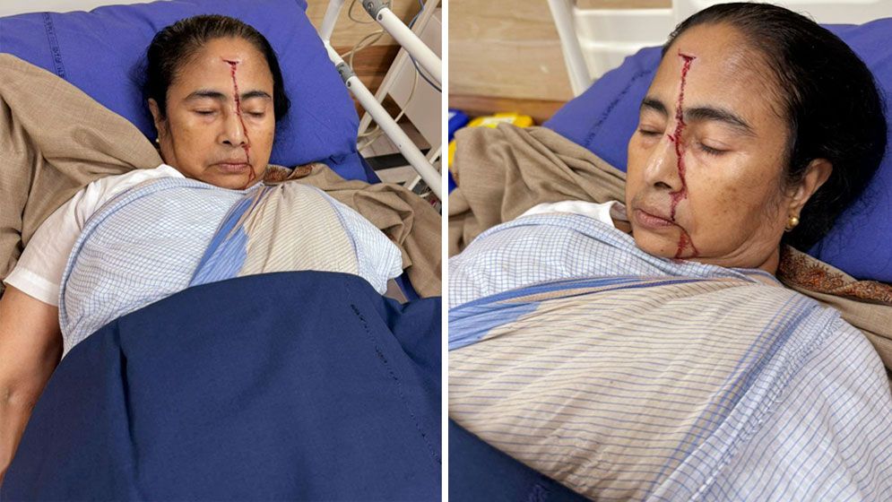 যেভাবে কপাল ফেটে গুরুতর জখম হলেন মমতা ব্যানার্জি 