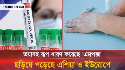 ভয়াবহ রূপ ধারণ করা এমপক্স যেভাবে ছড়াচ্ছে? এ রোগের লক্ষণগুলো কী?