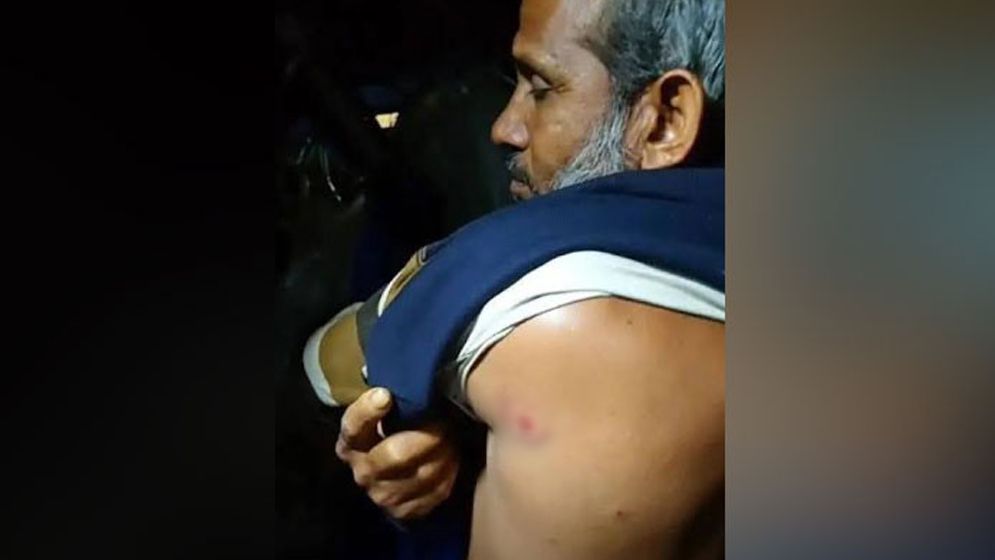 বঙ্গোপসাগরে জলদস্যুদের গুলিতে দুই জেলে আহত