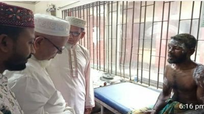 আগুনে নিঃস্ব কৃষক, হাসপাতালে দেখতে গেলেন এমপি ইলিয়াস মোল্যা 