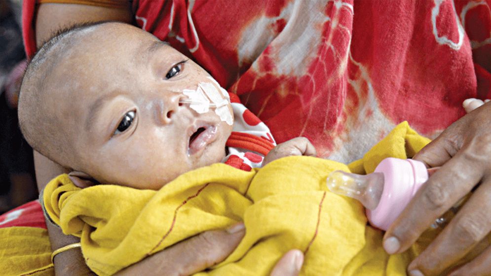 হাম ও উপসর্গ নিয়ে আরো ৩ শিশুর মৃত্যু