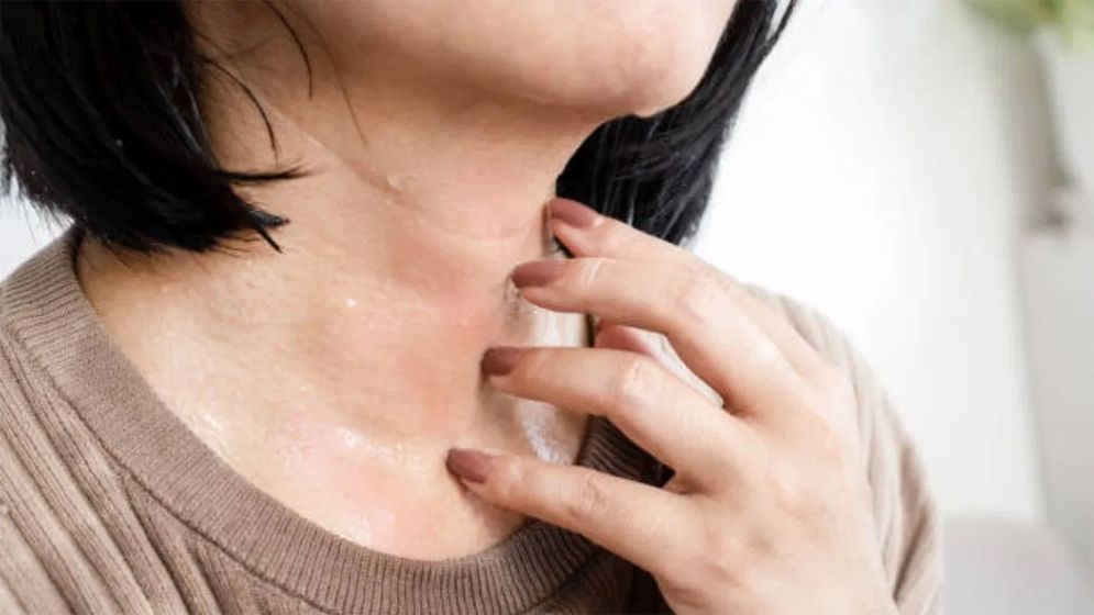 ভ্যাপসা গরমে ঘামের অস্বস্তি থেকে মুক্তির উপায়