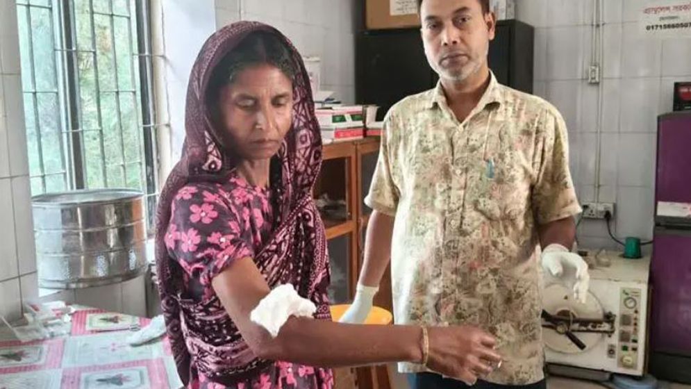 এক কুকুরের কামড়ে দুই দিনে অর্ধশতাধিক আহত