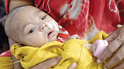 হাম ও উপসর্গ নিয়ে আরো ৩ শিশুর মৃত্যু