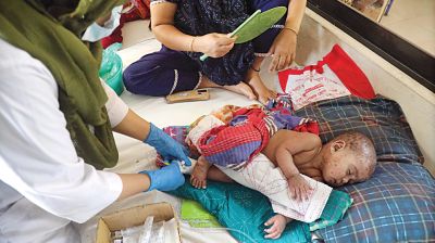 খুলনায় হামের উপসর্গে শিশুর মৃত্যু, ভর্তি ২২ রোগী