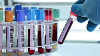 বরিশালের দুই পুলিশ সদস্য ডোপ টেস্টে পজিটিভ 