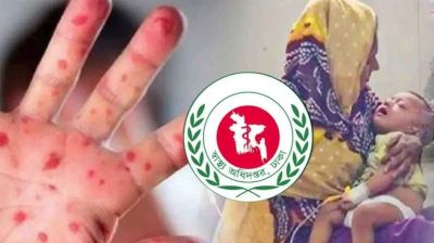 হাম পরিস্থিতি নিয়ে স্বাস্থ্য অধিদপ্তরের ব্রিফিং দুপুরে 