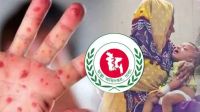 দুপুরে হাম পরিস্থিতি নিয়ে স্বাস্থ্য অধিদপ্তরের ব্রিফিং