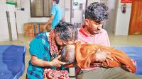 হাম ও উপসর্গে মৃত্যু ছাড়ালো সাড়ে ৩০০