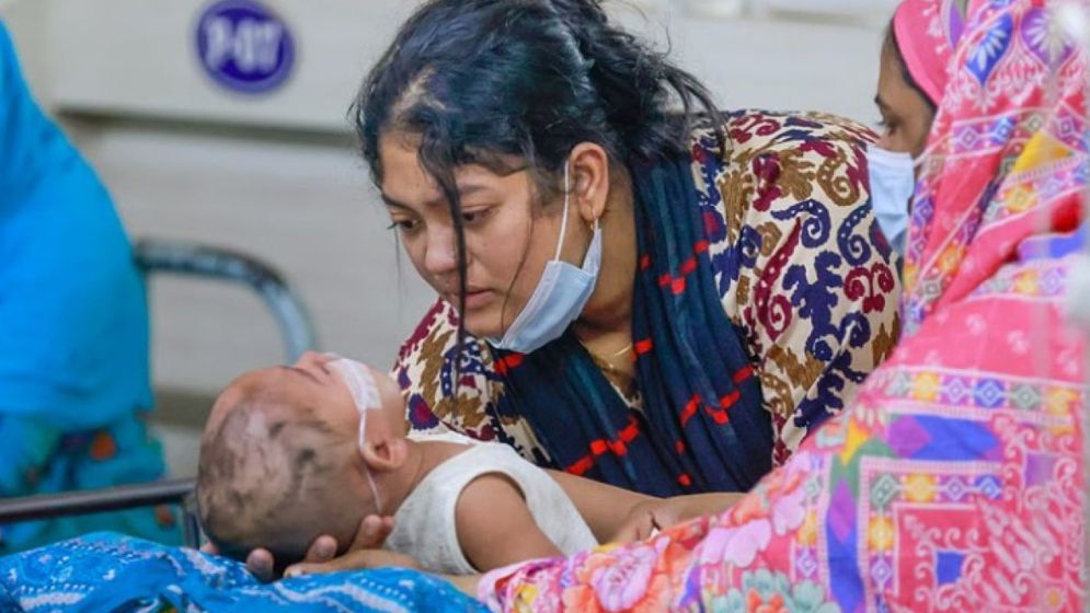 হাম উপসর্গে আরো ৭ শিশুর মৃত্যু